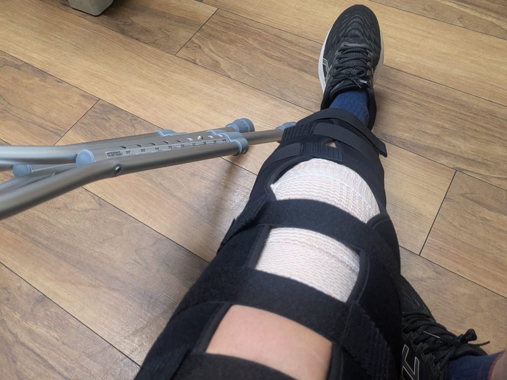 My recovery from a patella dislocation: from crutches to jogging in 6&nbsp;weeks
